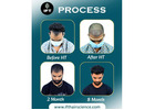 hair transplant clinic